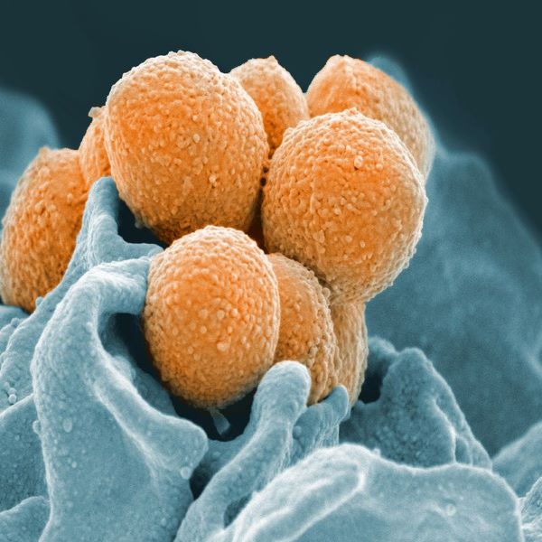 Group A Streptococcal Infections